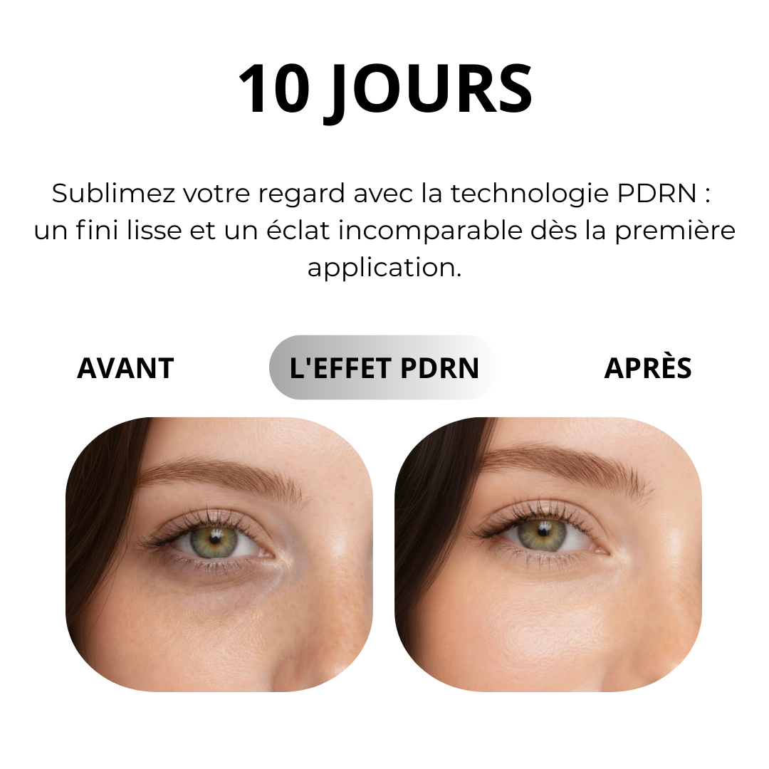 Patchs contour des yeux PDRN KOEC+