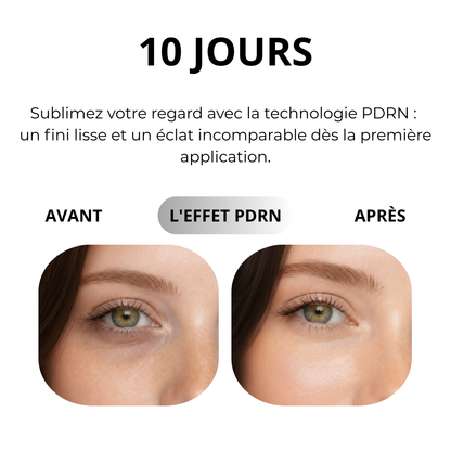 Patchs contour des yeux PDRN KOEC+